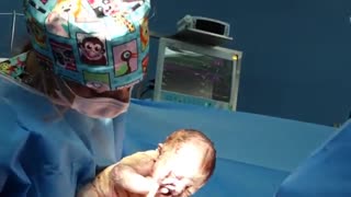 عمل زایمان سزارین