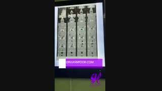 جراحی آندوسکوپی سینوس