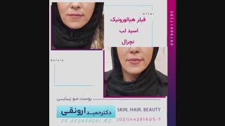 نمونه کارهای واقعی قبل و بعد از اقدامات زیبایی و جوانسازی صورت دندانپزشکی کودکان