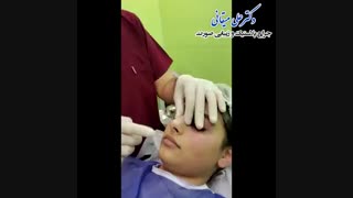 جراحی بینی بسته