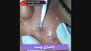 تخلیه جوش