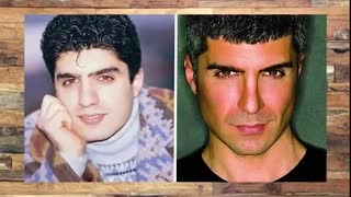 5 بازیگر مرد ترکیه که عمل زیبایی انجام دادند