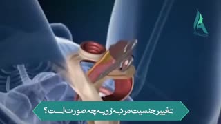 توضیحاتی درخصوص تغییر جنسیت مرد به زن