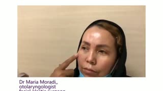 فیلم واقعی جراحی 4 پلک همزمان