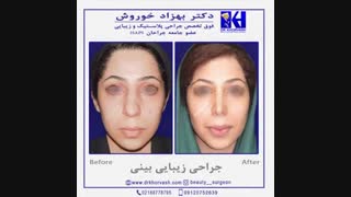 جراحی زیبایی بینی