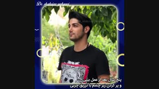 پنج سال بعد از عمل زیبایی بینی و تزریق چربی زیر چشم