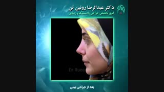جراحی بینی | فوق تخصص جراحی پلاستیک | دکتر عبدالرضا روئین تن