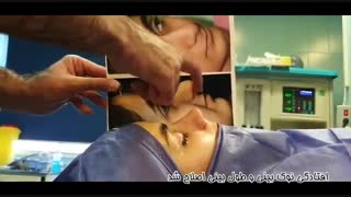 فیلم جراحی بینی استخوانی