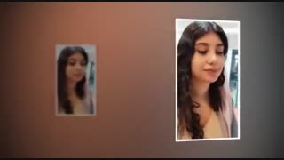 فیلم جراحی بینی نیمه گوشتی - نمونه کار واقعی