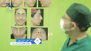 عمل زیبایی بینی در کرج