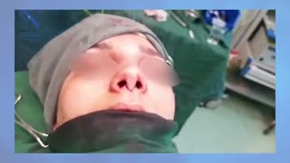 فیلم مراحل جراحی بینی در اتاق عمل