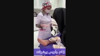 درمان زخم واریس - دکتر فریبا هندسی آر اف فرکشنال