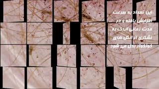 شامپو دیفنوترین | از بین برنده شپش سر