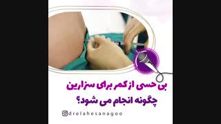بی حسی از کمر برای سزارین
