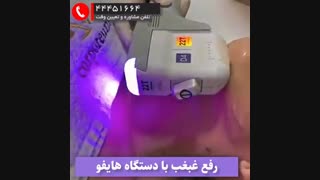 هایفو 4