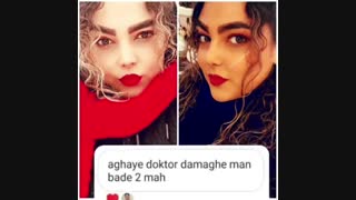 جراحی بینی بعد از دو ماه