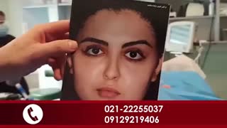 لیفت آندوسکوپ پیشانی و ابرو