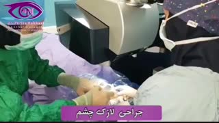 فیلم واقعی جراحی لازک چشم