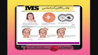 دمو تدریس نرولوژی  استاد دکترالماسی آمادگی آزمون رزیدنتی(ماهان-نوآوران دانش)