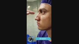 فیلم عمل بینی با پوست ضخیم و چرب