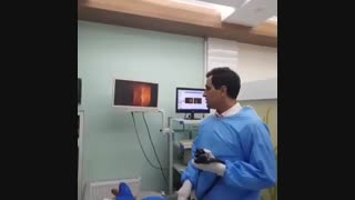 فیلم کولونوسکوپی کامل روده بزرگ و مشاهده دو پولیپ حیرت انگیز(بزرگ و کوچک)