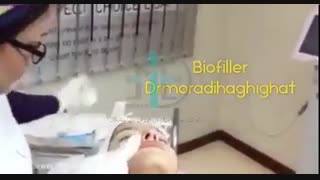 تزریق و جوانسازی پوست با Bio Filler Maker
