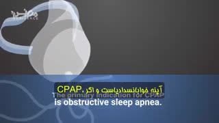 تفاوت بین بای پپ و سی پپ چیست؟