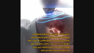 تصویر برداری از جنین