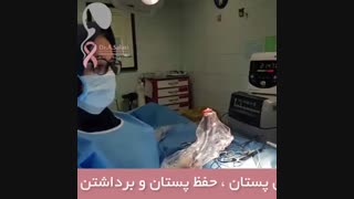 فیلم جراحی سرطان پستان