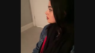 نمونه کار عمل بینی استخوانی سر بالا