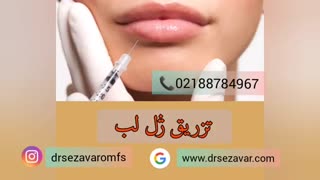 تزریق ژل لب