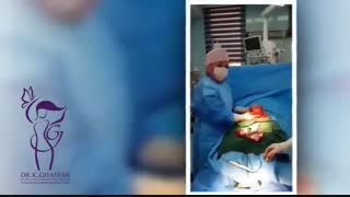 فیلم واقعی عمل میومکتومی در بیمارستان آپادانای اهواز