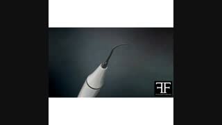 جرم گیری دندان ها