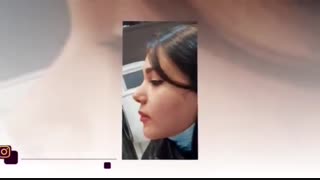 فیلم واقعی جراحی تیپ پلاستی و برداشتن قوز بینی