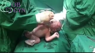 فیلم واقعی زایمان