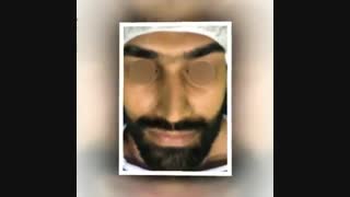 نمونه کارهای عمل بینی توسط دکتر مسعود انظاری