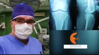 عمل جراحی جوانى که دچار شکستگى زانو شدند
