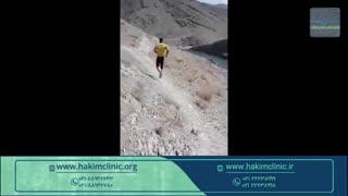 ساخت پای مصنوعی