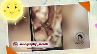 سونوگرافى دقیق و واضح در سونوگرافى سروش