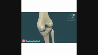 فیلم جراحی تعویض مفصل زانو