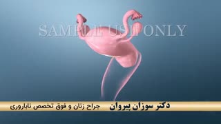 غربالگری سرطان دهانه رحم | متخصص زنان و زایمان و درمان های فوق تخصصی ناباروری | دکتر سوزان پیروان
