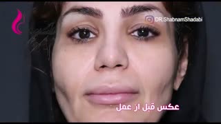 فیلم سانترال لب