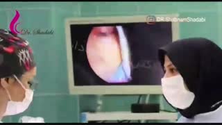 فیلم اندوسکوپی سینوس قارچی