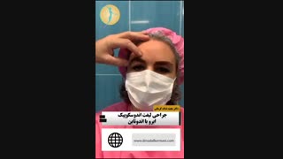 جراحی لیفت ابرو با اندوتاین