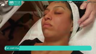 چگونگی انجام میکرودرم ابریژن ( رفع جوش های زیر پوستی صورت ) ترمیم سوختگی