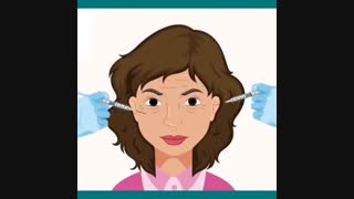 فیلم تزریق ژل و بوتاکس