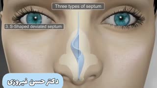 چگونگی جراحی بینی