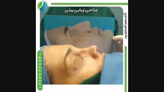 نمونه کارهای جراحی زیبایی بینی