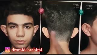 فیلم عمل اتوپلاستی