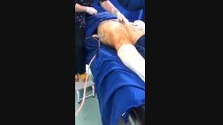 فیلم عمل لیفت ران توسط دکتر افسانه ثنایی